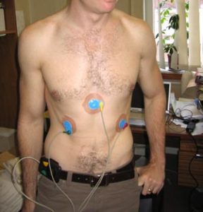 holter-monitor